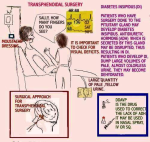 ce transphenodial surgery