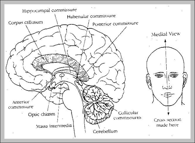 cerebral peduncle