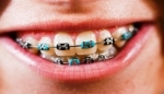 close up kid with braces