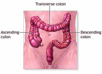 colon cancer colon diagram