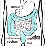 colon cancer screening