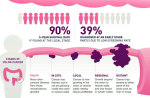 colon cancer stages