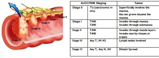 colon stages detailed