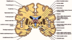 coronal section of the brain