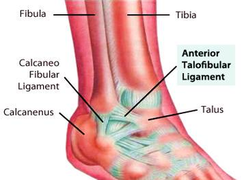 diagram ankle injury treatment