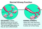 diagram asthma attack anatomy