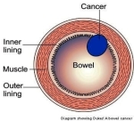 diagram crukmig