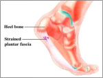 diagram easy plantar fasciitis stretches foot