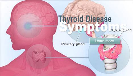 diagram of article thyroid disease