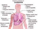 diagram of blood cancer symptoms