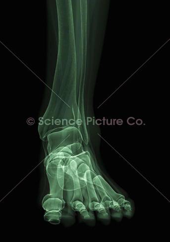 diagram of bones of the foot spc id