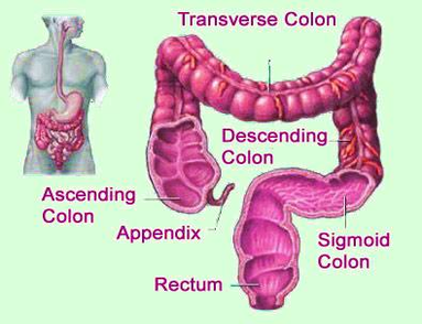 diagram of colon cancer prevention