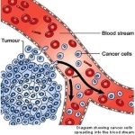 diagram of crukmig