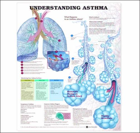 diagram pt understanding asthma