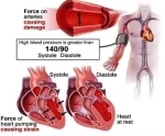 diastolic blood pressure