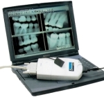 digital dental xray