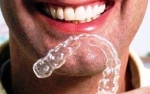 do dental insurance plans cover invisalign