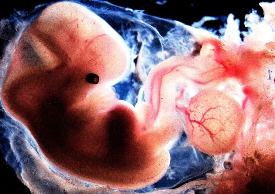 embryo weeks old1