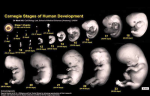 fetal growth