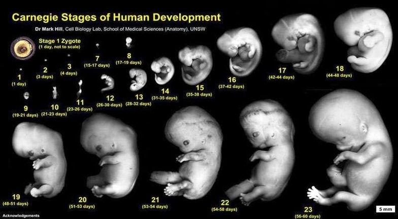 fetal growth