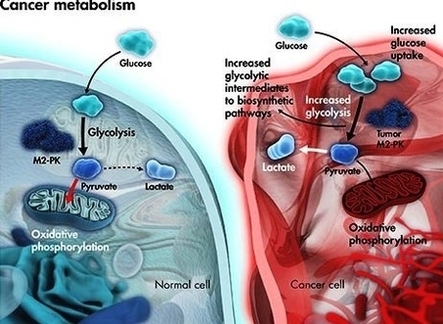 figure cancermetabolism