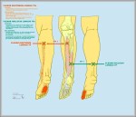 flexor digitorum longus 1024x907