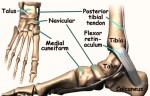 foot accessory navicular anat