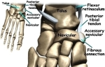 foot accessory navicular anat1