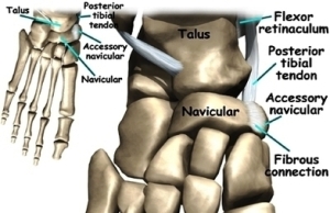 foot accessory navicular anat | Anatomy System - Human Body Anatomy ...