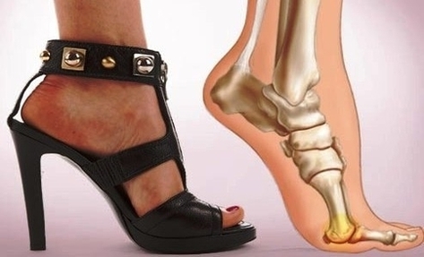 foot pain from heels
