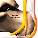 foot plantar fasciitis causes