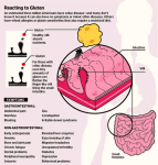 gluten free diagram