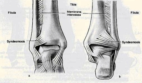 high ankle anatomy