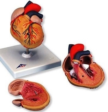 high blood pressure hypertophy heart anatomy model
