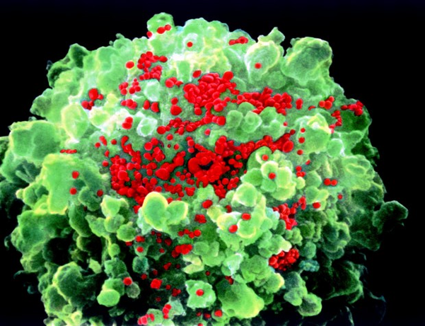 hiv virus photo