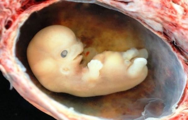 human embryo approximately weeks estimated gestational age