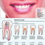 human teeth