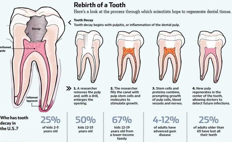 human teeth