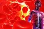 hypertension