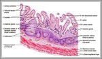 ileum picture