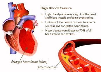 image high blood pressure