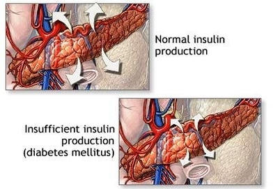 insulin production and diabetes
