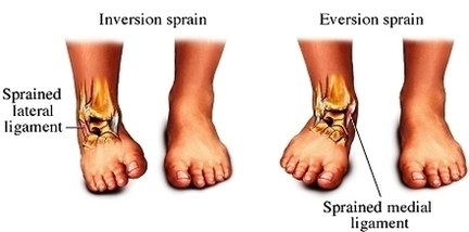 inversion and eversion sprains