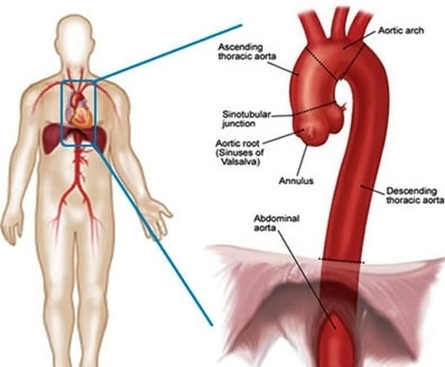 lg heart aortic anatomy