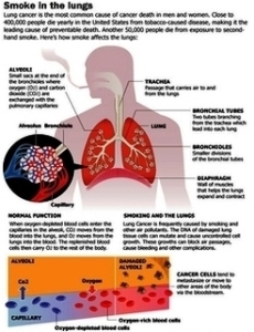 lung cancer smoking | Anatomy System - Human Body Anatomy diagram and ...