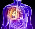 lung cancer treatment