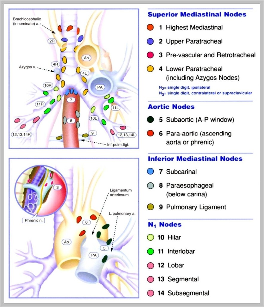 mediastinal nodes 1024x1231