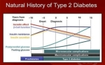 natural history of type diabetes