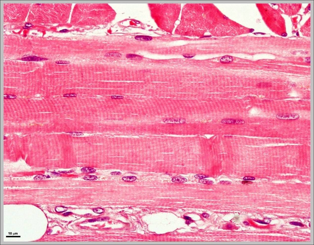 picture of skeletal muscle
