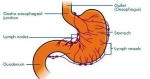 stomach lymphnodes